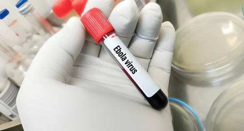 Ebola in Congo, oltre 4.000 casi: l�epidemia continua a espandersi